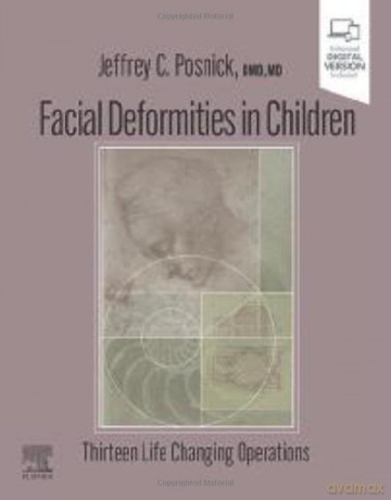 Facial Deformities In Children - Jeffrey C. Posnick [KSIĄŻKA]