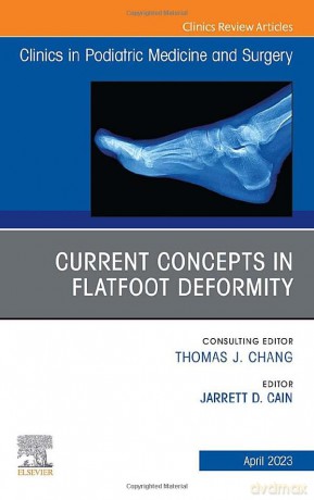 Current Concepts In Flatfoot Deformity A - Jarrett D. Cain [KSIĄŻKA]