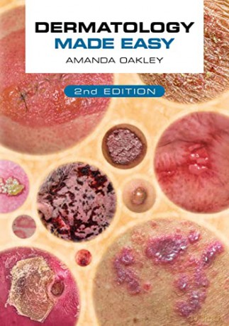 Dermatology Made Easy Second Edition [KSIĄŻKA]