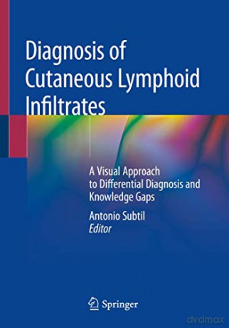 Diagnosis Of Cutaneous Lymphoid Infiltra - Antonio Subtil [KSIĄŻKA]