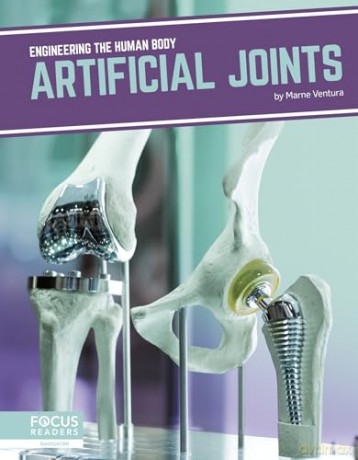 Artificial Joints - Marne Ventura [KSIĄŻKA]