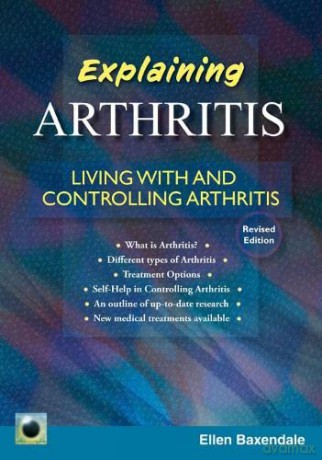 Explaining Arthritis - Ellen Baxendale [KSIĄŻKA]