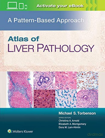 Atlas Liver Pancreas Pathology 1e - Torbenson Michael [KSIĄŻKA]