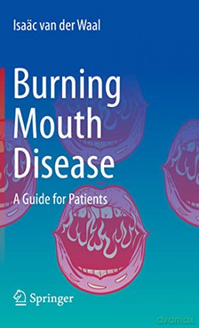 Burning Mouth Disease - Isa C Van Der Waal [KSIĄŻKA]