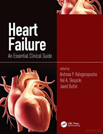 Heart Failure Guide - Andr Kalogeropoulos [KSIĄŻKA]