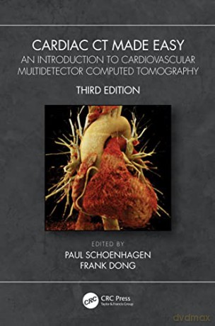 Cardiac Ct Made Easy 3e [KSIĄŻKA]