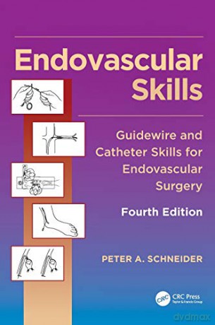 The Endovascular Skills: Guidewire And Cathe - Peter A. Schneider [KSIĄŻKA]