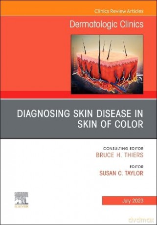 Diagnosing Skin Disease In Skin Of Color - Susan C. Taylor [KSIĄŻKA]