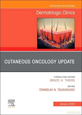 Cutaneous Oncology Update An Issue Of De - Stan N. Tolkachjov [KSIĄŻKA]