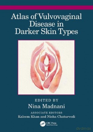 Atlas Of Vulvovaginal Diseases In Skin O - Nina Madnani [KSIĄŻKA]