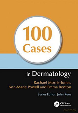 100 Cases In Dermatology - Emma Et Al Benton [KSIĄŻKA]