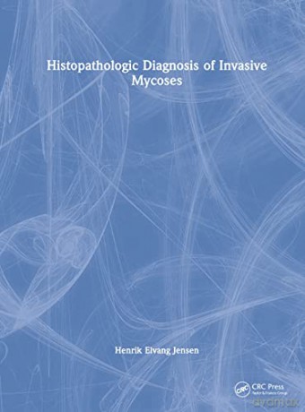 Histopathologic Diagnosis Of Invasive My - Henrik Elvan Jensen [KSIĄŻKA]