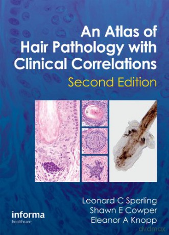 Atlas Of Hair Pathology 2e - Sperling [KSIĄŻKA]