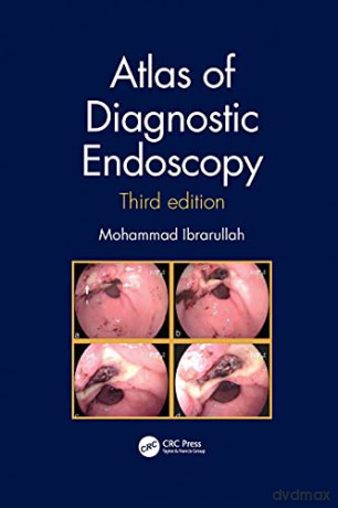 Atlas Of Diagnostic Endoscopy 3e - Mohammad Ibrarullah [KSIĄŻKA]