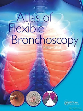 Atlas Of Flexible Bronchoscopy - Pallav Shah [KSIĄŻKA]
