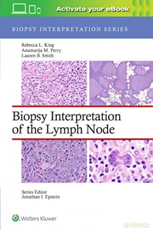 Biopsy Interpretation Of The Lymph Nodes - Rebecca King [KSIĄŻKA]