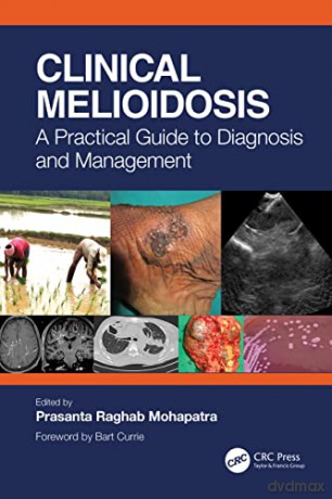 Clinical Melioidosis - Pr Raghab Mohapatra [KSIĄŻKA]