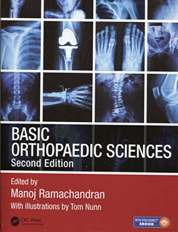 Basic Orthopaedic Sciences - Manoj Ramachandran [KSIĄŻKA]