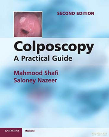 Colposcopy - Mahmood Shafi [KSIĄŻKA]