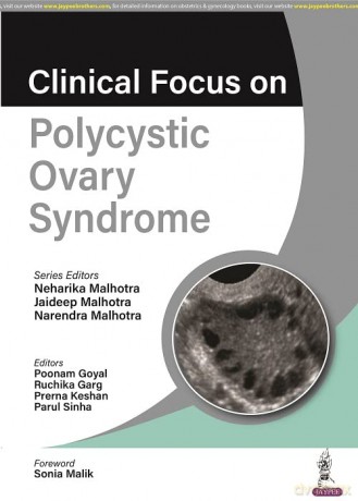 Clinical Focus On Polycystic Ovary Synd [KSIĄŻKA]