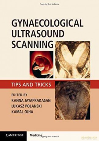 Gynecological Ultrasound Scanning - Kanna Jayaprakasan [KSIĄŻKA]