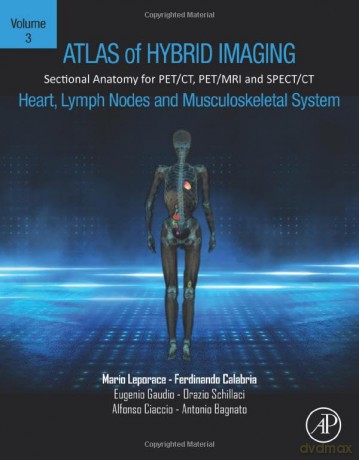 Atlas Of Hybrid Imaging Of The Heart Lym - Mario Leporace [KSIĄŻKA]