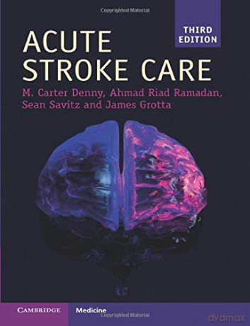 Acute Stroke Care - Grotta James [KSIĄŻKA]