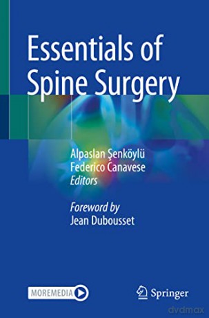 Essentials Of Spne Surgery [KSIĄŻKA]