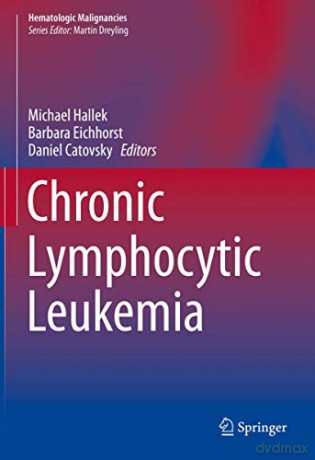Chronic Lymphocytic Leukemia - Michael Hallek [KSIĄŻKA]