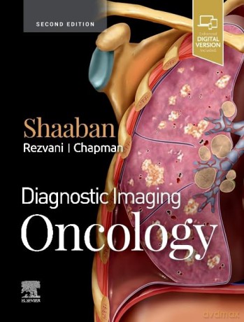 Diagnostic Imaging Oncology 2 - Akram M. Shaaban [KSIĄŻKA]