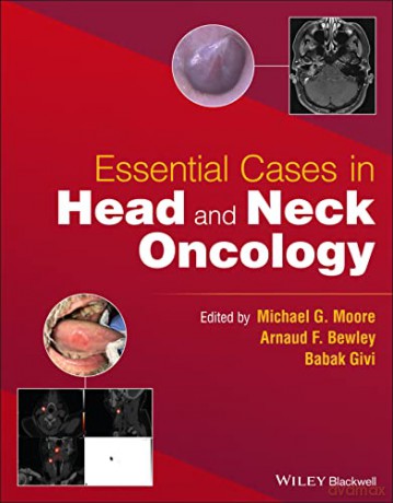 Essential Cases In Head And Neck Oncolo [KSIĄŻKA]