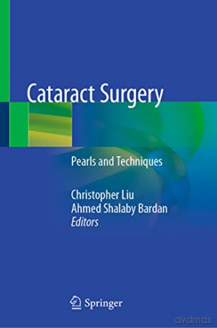 Cataract Surgery - Christopher Liu [KSIĄŻKA]