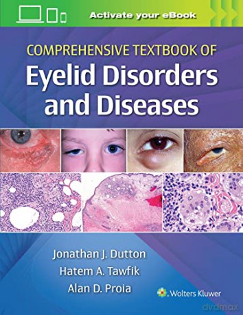 Comprehensive Textbook Of Eyelid Disorde - Jonathan Dutton [KSIĄŻKA]
