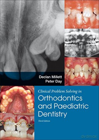 Clinical Problem Solving In Dentistry Or - Declan Millett [KSIĄŻKA]