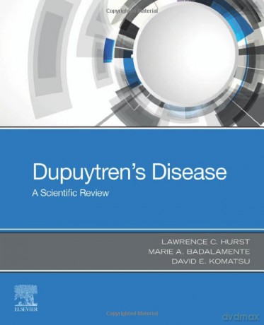 Dupuytrens Disease - Lawrence C. Hurst [KSIĄŻKA]