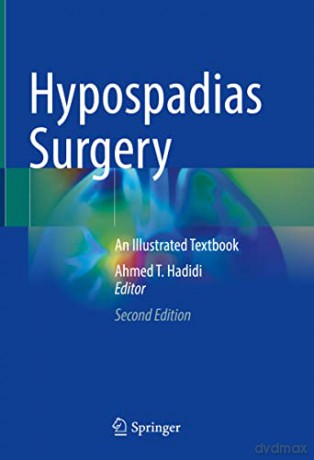Hypospadias Surgery - Ahmed T. Hadidi [KSIĄŻKA]