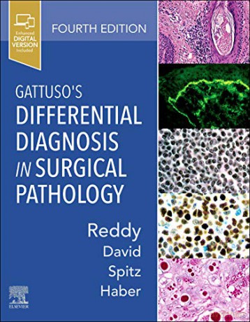 Gattusos Differential Diagnosis In Surgi - Vijaya B Reddy [KSIĄŻKA]