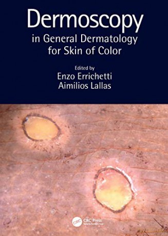 Dermoscopy In General Dermatology For Sk - Enzo Errichetti [KSIĄŻKA]