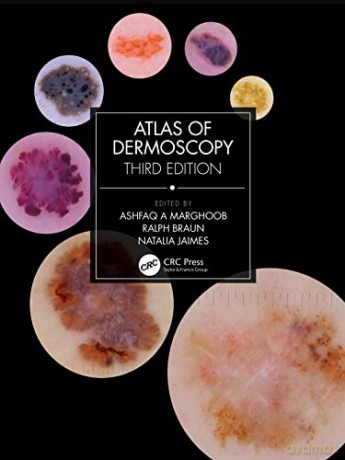 Atlas Of Dermoscopy - Ashfaq A Marghoob [KSIĄŻKA]