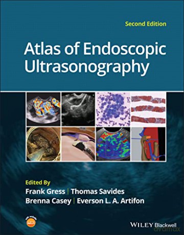 Atlas Of Endoscopic Ultrasonography [KSIĄŻKA]