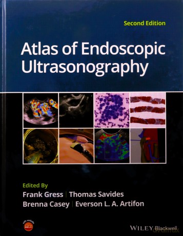 Atlas Of Endoscopic Ultrasonography [KSIĄŻKA]