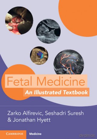 Fetal Medicine - Zarko Alfirevic [KSIĄŻKA]