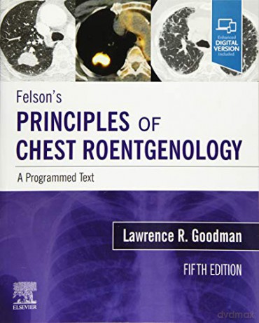 Felsons Principles Of Chest Roentgenolog - Lawrence R. Goodman [KSIĄŻKA]