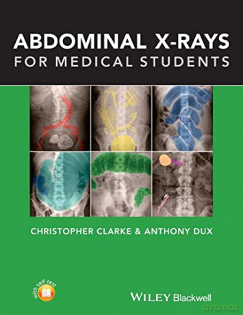 Abdominal Xrays For Medical Students - Christopher Clarke [KSIĄŻKA]