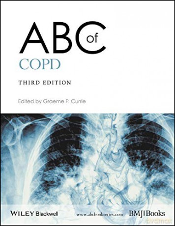 Abc Of Copd 3e [KSIĄŻKA]
