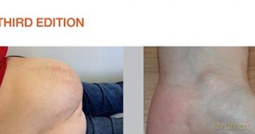Clinical Cases And Osces In Surgery [KSIĄŻKA]