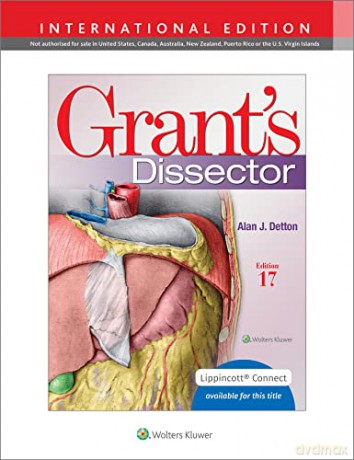 Grants Dissector 17e Revised Int Ed - Alan Detton [KSIĄŻKA]