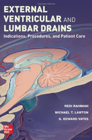 External Ventricular And Lumbar Drains [KSIĄŻKA]