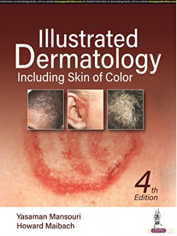 Illustrated Dermatology [KSIĄŻKA]