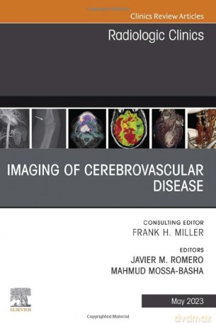 Imaging Of Cerebrovascular Disease An Is - Javier M. Romero [KSIĄŻKA]